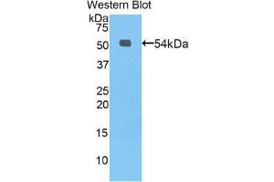 Western Blotting (WB) image for anti-Vitamin K-dependent protein C (PROC) (AA 197-436) antibody (ABIN1860318) (PROC anticorps  (AA 197-436))