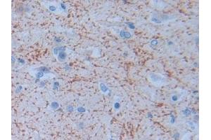 Detection of PRSS2 in Human Cerebrum Tissue using Polyclonal Antibody to Protease, Serine 2 (PRSS2)