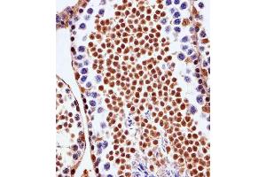 Immunohistochemical analysis of paraffin-embedded M. (PSMD10 anticorps  (AA 43-76))
