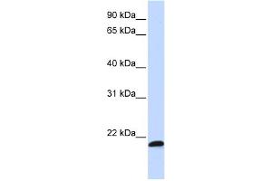 WB Suggested Anti-C21orf56 Antibody Titration:  0. (C21ORF56 anticorps  (Middle Region))