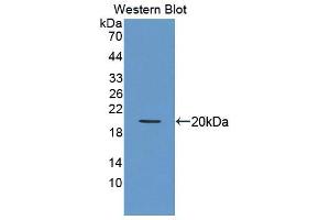 Western blot analysis of the recombinant protein. (Sonic Hedgehog anticorps  (AA 28-193))