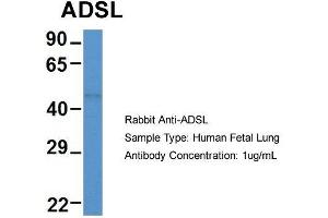 Host: Rabbit  Target Name: ADSL  Sample Tissue: Human Fetal Lung  Antibody Dilution: 1. (Adenylosuccinate Lyase anticorps  (Middle Region))