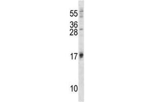 ISG15 antibody western blot analysis in 293 lysate