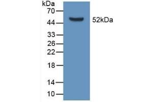 Detection of Recombinant APOD, Mouse using Polyclonal Antibody to Apolipoprotein D (APOD) (Apolipoprotein D anticorps  (AA 1-189))