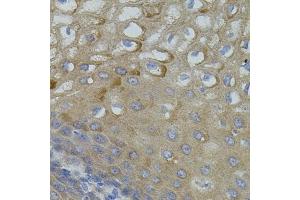Immunohistochemistry of paraffin-embedded human esophagus using Mitofusin 2 antibody (ABIN6128301, ABIN6143801, ABIN6143804 and ABIN6217669) (40x lens).
