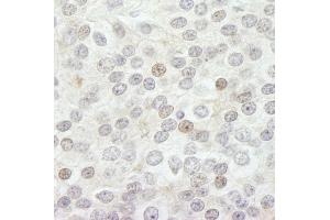 Immunohistochemistry (IHC) image for anti-Lysine (K)-Specific Demethylase 5B (KDM5B) (AA 1494-1544) antibody (ABIN7448613) (KDM5B anticorps  (AA 1494-1544))