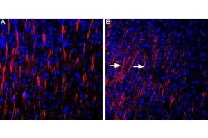 Expression of Shank3 in rat and mouse parietal cortex - Immunohistochemical staining of perfusion-fixed frozen rat and mouse brain sections using Anti-Shank3 Antibody (ABIN7043627, ABIN7045154 and ABIN7045155), (1:400), followed by anti-rabbit-Cy3 antibody (red).