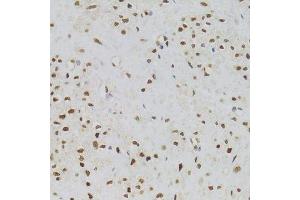 Immunohistochemistry of paraffin-embedded human leiomyoma of uterus using NASP Antibody.
