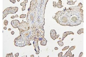 IHC analysis of IRS1 using anti-IRS1 antibody (ABIN7599659). (IRS1 anticorps  (AA 1041-1242))