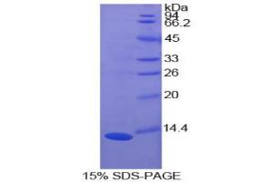 SDS-PAGE analysis of Cow S100A10 Protein. (S100A10 Protéine)