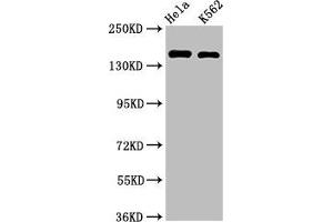 Western Blot Positive WB detected in: Hela whole cell lysate, K562 whole cell lysate All lanes: CDK12 antibody at 2 μg/mL Secondary Goat polyclonal to rabbit IgG at 1/50000 dilution Predicted band size: 165, 164, 142 kDa Observed band size: 165 kDa (CDK12 anticorps  (AA 1309-1490))