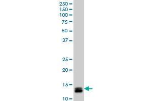 ID1 monoclonal antibody (M04), clone 4G11 Western Blot analysis of ID1 expression in Y-79 .