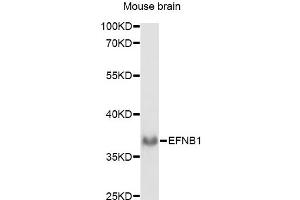 Western blot analysis of extracts of mouse brain, using EFNB1 antibody. (Ephrin B1 anticorps)