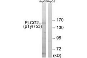Western blot analysis of extracts from HepG2 cells treated with Na3VO4 0. (Phospholipase C gamma 2 anticorps  (pTyr753))