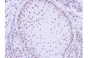 IHC-P Image Immunohistochemical analysis of paraffin-embedded Cal27 xenograft, using PRP19, antibody at 1:500 dilution.