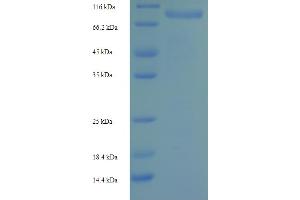 SDS-PAGE (SDS) image for Ribonucleotide Reductase M1 (RRM1) (AA 1-792), (full length) protein (His-SUMO Tag) (ABIN5710282)