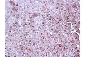 Formalin-fixed and paraffin embedded rat liver tissue labeled with Anti-FoxP3 Polyclonal Antibody, Unconjugated (ABIN727040) at 1:100, followed by conjugation to the secondary antibody and DAB staining (FOXP3 anticorps)