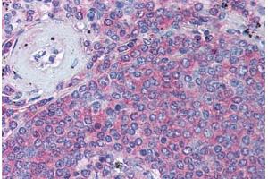 Spleen (IKKi/IKKe anticorps  (AA 701-716))