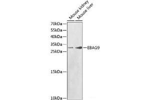 Western blot analysis of extracts of various cell lines using EBAG9 Polyclonal Antibody at dilution of 1:1000. (RCAS1 anticorps)