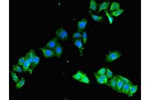 anti-FCH Domain Only 2 (FCHO2) (AA 100-203) antibody
