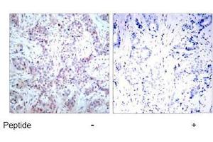 Image no. 1 for anti-Nuclear Factor-kB p65 (NFkBP65) (AA 534-538) antibody (ABIN197116) (NF-kB p65 anticorps  (AA 534-538))