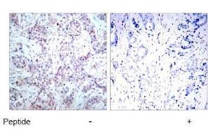 Image no. 1 for anti-Nuclear Factor-kB p65 (NFkBP65) (AA 534-538) antibody (ABIN197117) (NF-kB p65 anticorps  (AA 534-538))