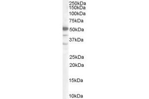 Western Blotting (WB) image for anti-SWI/SNF Related, Matrix Associated, Actin Dependent Regulator of Chromatin, Subfamily E, Member 1 (SMARCE1) (C-Term) antibody (ABIN2465457) (SMARCE1 anticorps  (C-Term))