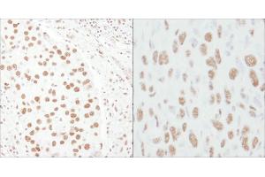 anti-Transcription Elongation Regulator 1 (TCERG1) (AA 1-50) antibody
