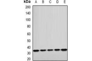 Western blot analysis of ETFA expression in A549 (A), HepG2 (B), mouse kidney (C), mouse heart (D), rat liver (E) whole cell lysates. (ETFA anticorps)