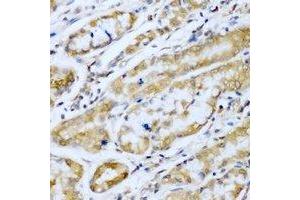 Immunohistochemical analysis of SUFU staining in human stomach formalin fixed paraffin embedded tissue section. (SUFUH anticorps)