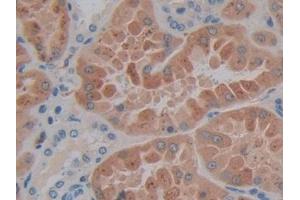 IHC-P analysis of Human Kidney Tissue, with DAB staining. (SP140 anticorps  (AA 443-655))