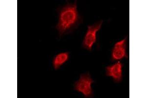 ABIN6276186 staining HeLa by IF/ICC. (OR7C1 anticorps  (Internal Region))