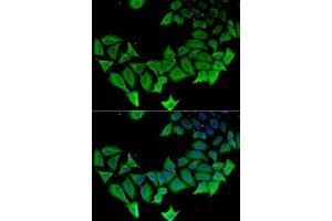Immunofluorescence analysis of HeLa cells using APLP1 antibody.