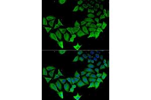 Immunofluorescence analysis of HeLa cells using APLP1 antibody. (APLP1 anticorps  (AA 39-300))