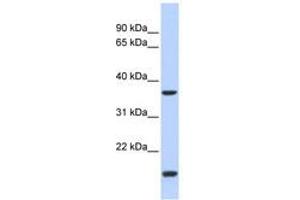 Image no. 1 for anti-Zic Family Member 4 (ZIC4) (N-Term) antibody (ABIN6740619) (ZIC4 anticorps  (N-Term))