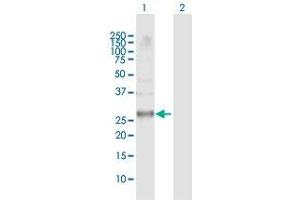 Western Blot analysis of CCRK expression in transfected 293T cell line by CCRK MaxPab polyclonal antibody.