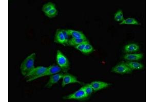 Immunofluorescent analysis of Hela cells using ABIN7172859 at dilution of 1:100 and Alexa Fluor 488-congugated AffiniPure Goat Anti-Rabbit IgG(H+L)