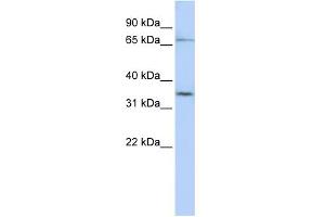 WB Suggested Anti-SLCO1C1 Antibody Titration:  0. (SLCO1C1 anticorps  (N-Term))