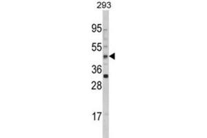 Western Blotting (WB) image for anti-Arylacetamide Deacetylase (Esterase) (AADAC) antibody (ABIN3002812)