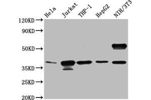 Western blot All lanes: CLYBL antibody at 1 μg/mL Lane 1: Hela whole cell lysate Lane 2: NIH/3T3 whole cell lysate Secondary Goat polyclonal to rabbit IgG at 1/10000 dilution Predicted band size: 38, 34 kDa Observed band size: 38 kDa