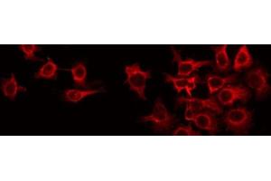 ABIN6266631 staining Hela by IF/ICC. (RIT1 anticorps  (C-Term))