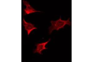 ABIN6274790 staining HT29 by IF/ICC. (ABHD2 anticorps  (Internal Region))