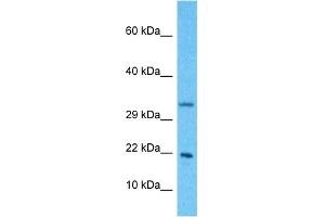 Host:  Rabbit  Target Name:  NDUFB11  Sample Type:  Hela Whole Cell lysates  Antibody Dilution:  1. (NDUFB11 anticorps  (N-Term))