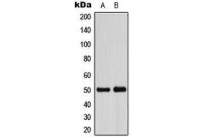 Western blot analysis of ADPGK expression in HeLa (A), VEC (B) whole cell lysates. (ADPGK anticorps  (Center))