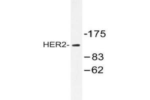 Western blot analysis of HER2 antibody in extracts from 293 cells. (ErbB2/Her2 anticorps)