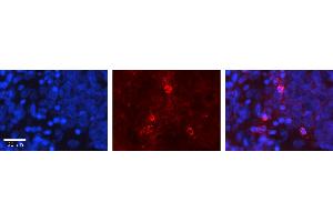 Rabbit Anti-GNA12 Antibody Catalog Number: ARP54813_P050 Formalin Fixed Paraffin Embedded Tissue: Human Ovary Tissue Observed Staining: Plasma membrane Primary Antibody Concentration: 1:100 Other Working Concentrations: 1:600 Secondary Antibody: Donkey anti-Rabbit-Cy3 Secondary Antibody Concentration: 1:200 Magnification: 20X Exposure Time: 0. (GNA12 anticorps  (Middle Region))