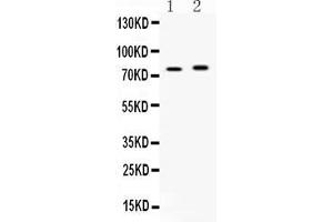 Western blot analysis of ACSL5 expression in rat brain extract ( Lane 1) and mouse brain extract ( Lane 2).