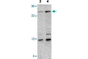 Western blot analysis of NKIRAS1 in 293 cell lysate with NKIRAS1 polyclonal antibody  at 2 and 4 ug/mL .