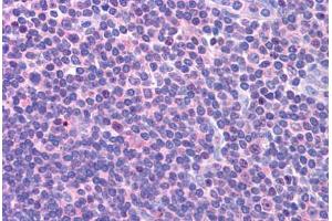 Human Lymph Node (formalin-fixed, paraffin-embedded) stained with DCLRE1C antibody ABIN298129 at 1. (DCLRE1C anticorps  (AA 482-495))