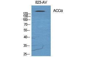 Western Blotting (WB) image for anti-Acetyl-CoA Carboxylase alpha (ACACA) (Ser122) antibody (ABIN3183142) (Acetyl-CoA Carboxylase alpha anticorps  (Ser122))